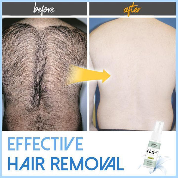 PERMANENT HAIR REMOVAL SPRAY