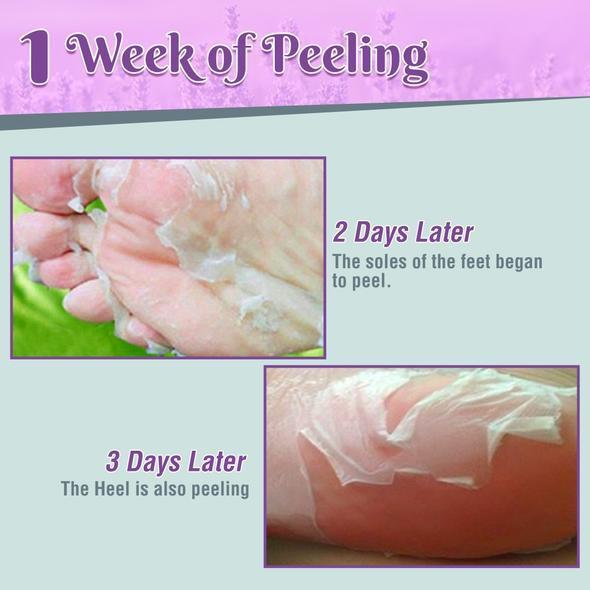 Deep Hydration Lavender Foot Peeling mask