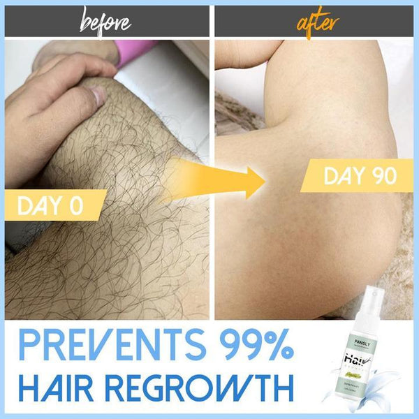 PERMANENT HAIR REMOVAL SPRAY