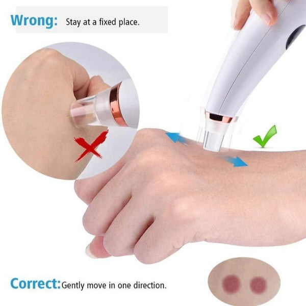 FACIAL DEEP PORE REMOVER ACNE VACUUM