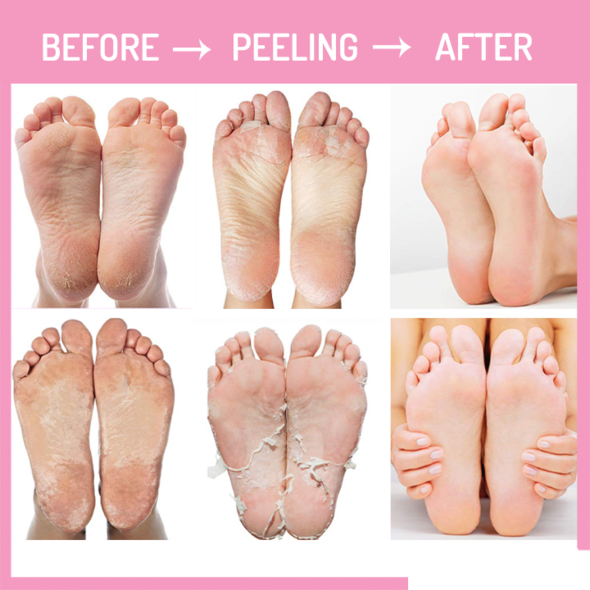 EXFOLIATING FOOT MASK