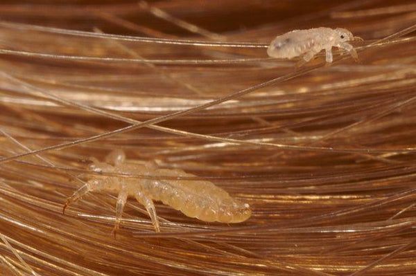Automatic Electric Head Lice Eliminator