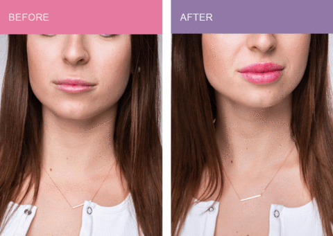 Premium Lip Plumper Natural Handheld Lip Enhancer Device Tool