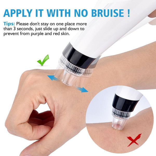 Blackhead Pore Vacuum for Brighter & Healthier Skin
