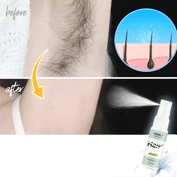 PERMANENT HAIR REMOVAL SPRAY