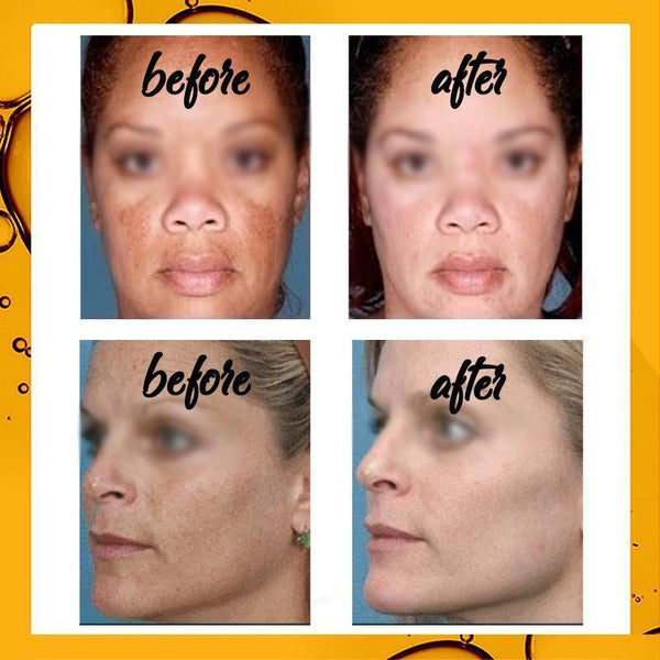 Dark Spot Curing Ampoule