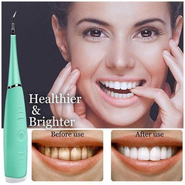 SONICSCRAPE - DENTAL CALCULUS PLAQUE REMOVER