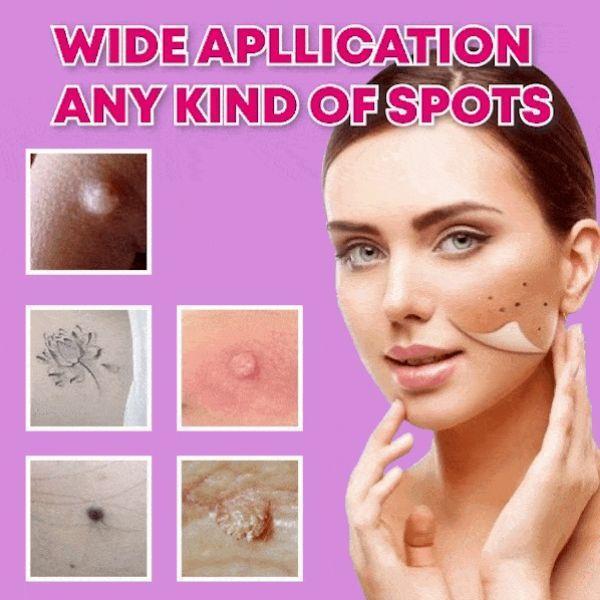 Instant Spots Removal Pen