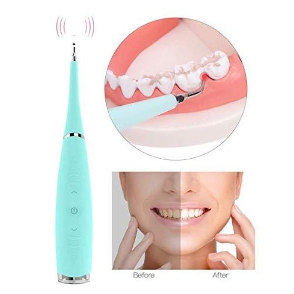 SONICSCRAPE - DENTAL CALCULUS PLAQUE REMOVER