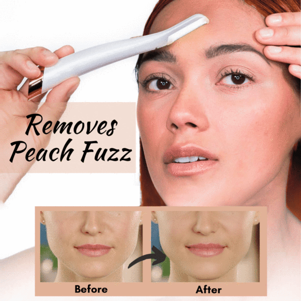 LED DERMAPLANING FACE EXFOLIATOR TOOL