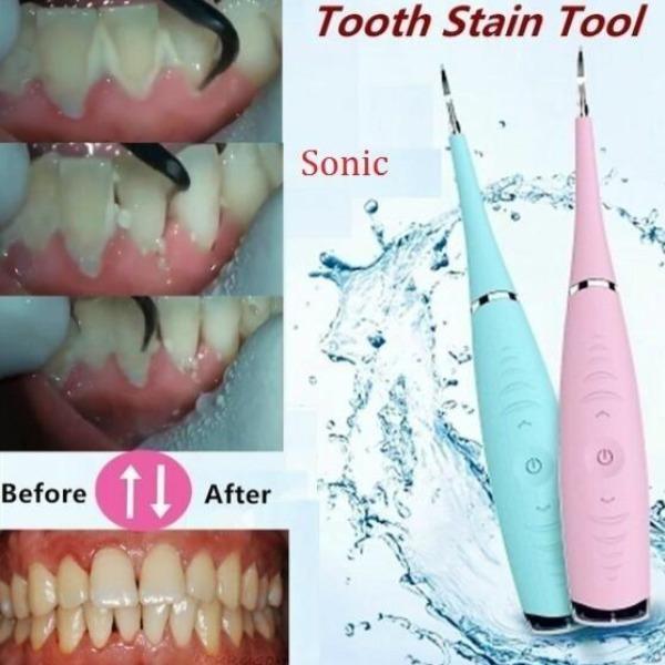 SONICSCRAPE - DENTAL CALCULUS PLAQUE REMOVER
