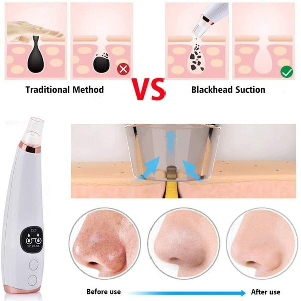 FACIAL DEEP PORE REMOVER ACNE VACUUM