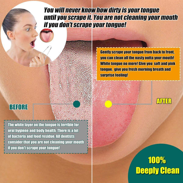 STAINLESS STEEL TONGUE SCRAPE CLEANER