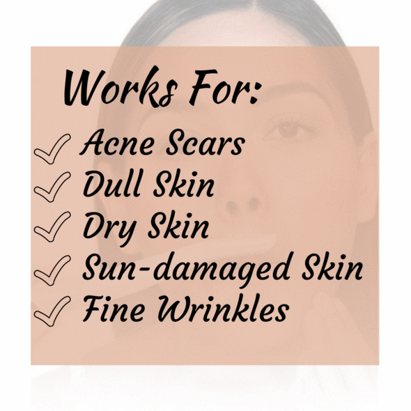 LED DERMAPLANING FACE EXFOLIATOR TOOL