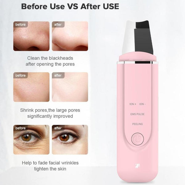 DERMA SKIN SCRUBBER PEN