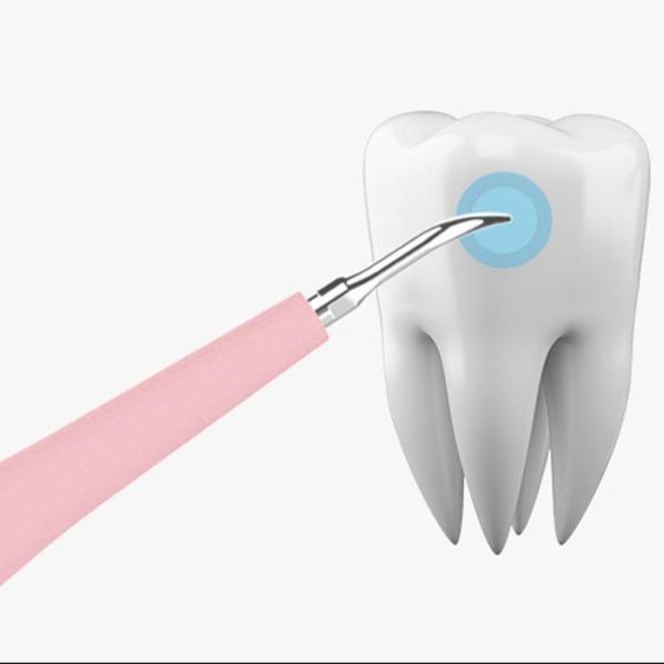 SONICSCRAPE - DENTAL CALCULUS PLAQUE REMOVER