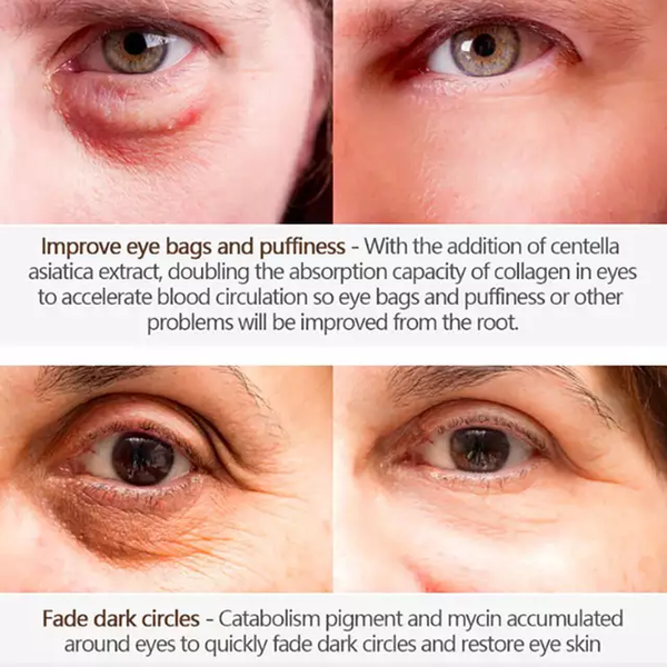 Magic Eye Cream - 28 seconds to remove eye bags / dark circles / eye wrinkles