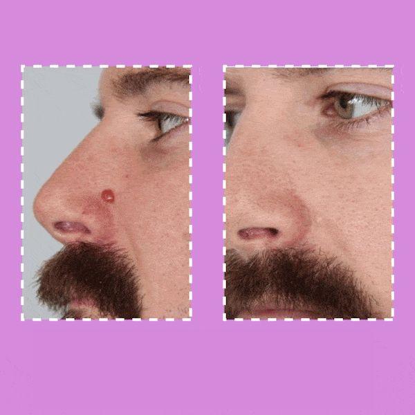 Instant Spots Removal Pen