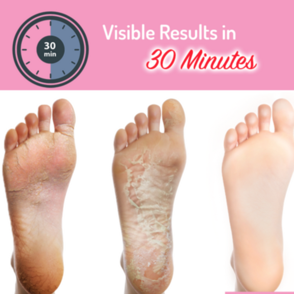 EXFOLIATING FOOT MASK