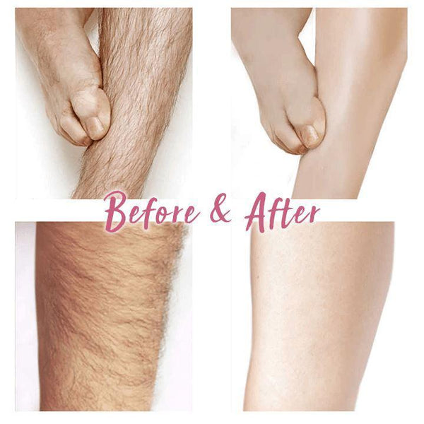 PERMANENT HAIR REMOVAL SPRAY