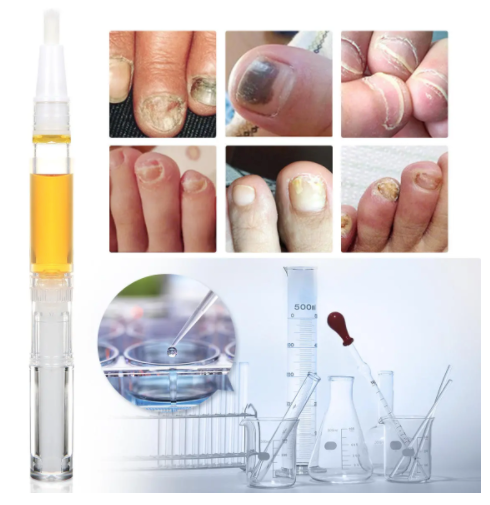 Skymore™ Toenail Fungus Treatment