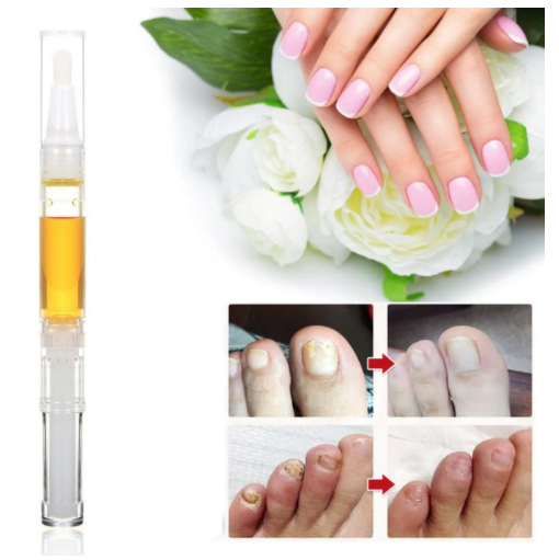 Skymore™ Toenail Fungus Treatment